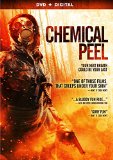 Chemical Peel