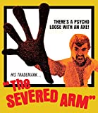 The Severed Arm