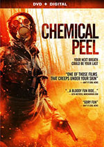 DVD Cover for Chemical Peel