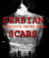 Serbian Scars